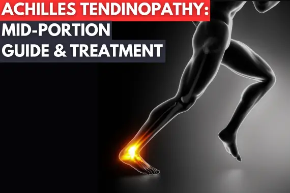 UNDERSTANDING AND MANAGING MID PORTION ACHILLES TENDINOPATHY